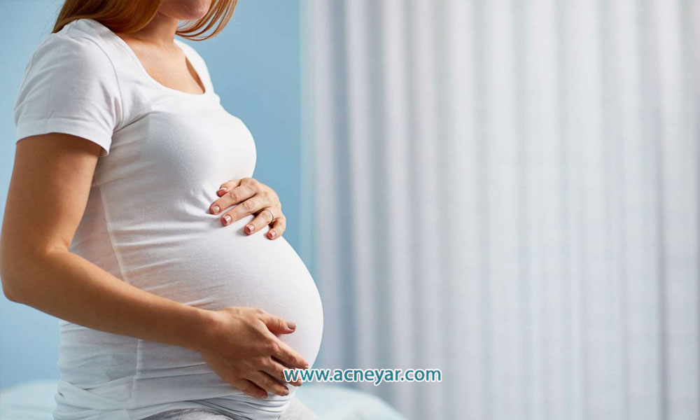درمان آكنه در دوران بارداري ويديو