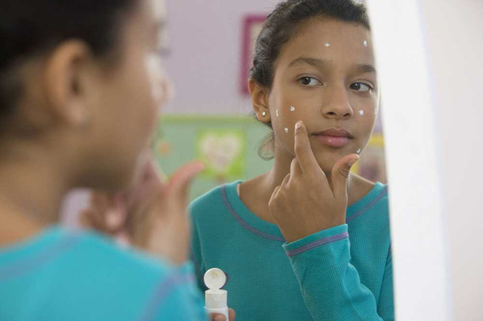 10 نکته ایی که دختران جوان درباره درمان جوش باید بدانند